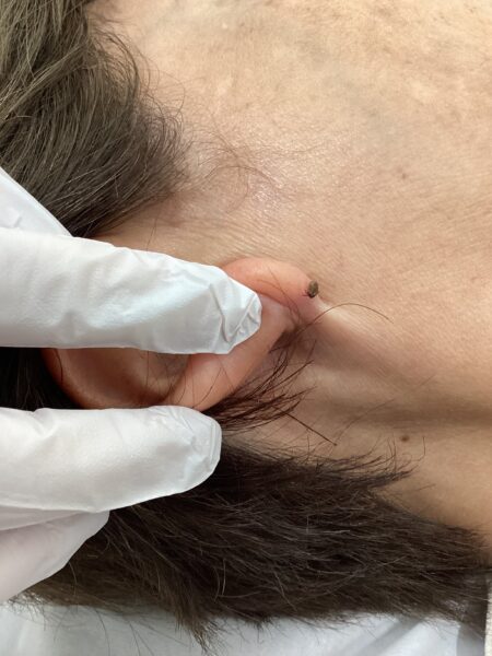 あれ?何か喰いついている!マダニ注意です!のアイキャッチ画像
